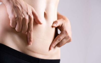 At-Home vs. Professional Scar Treatments: What’s the Difference?