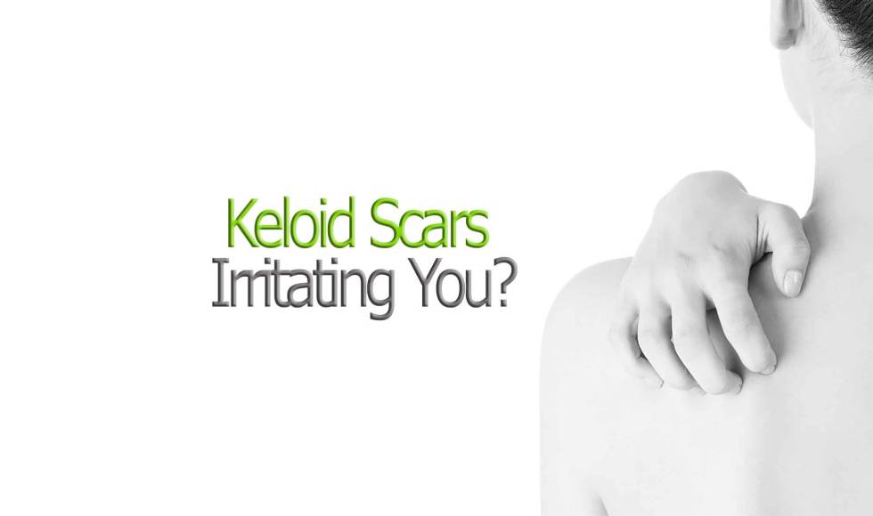 Keloid Scar Removal Treatment Toronto