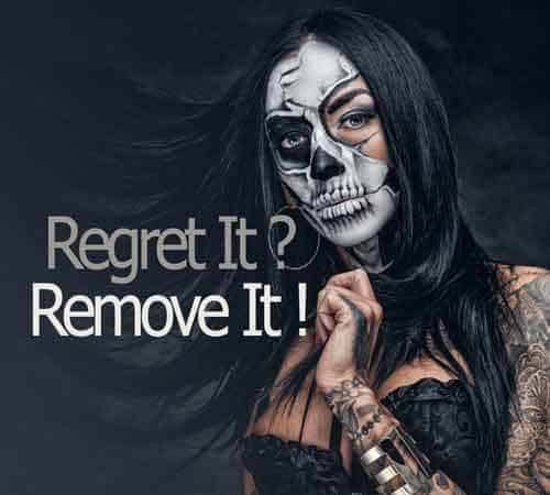 Tattoo Removal Banner Image