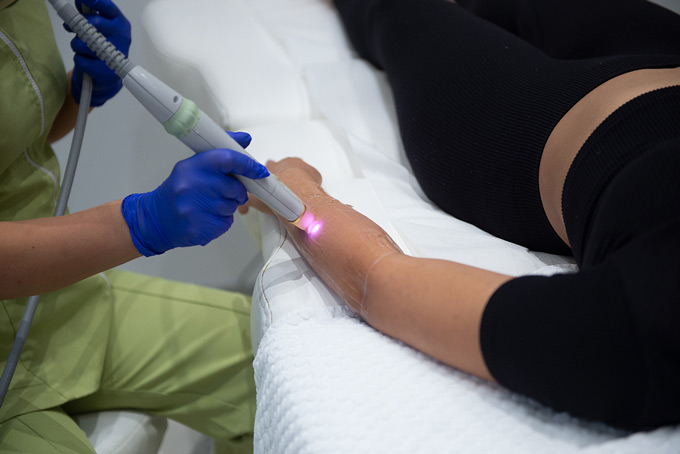 How Laser Hair Removal Works