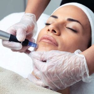bellair laser clinic treatment toronto