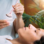 chemical peel