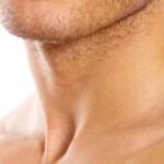 Photorejuvenation IPL Neck