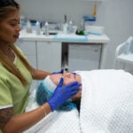 microdermabrasion treatment toronto