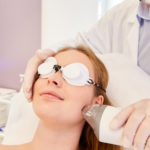 Thermage Eyes, Including Eyelids