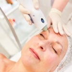3D Face (Titan, Laser Genesis & IPL)