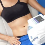 Coolsculpt Large Applicator