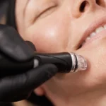Deluxe Hydrafacial