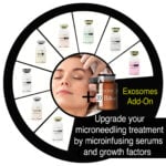 Add on Exosomes (no needling)