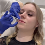 bellair laser clinic injection treatment toronto
