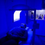 isolaz laser treatment toronto
