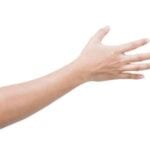 Photorejuvenation IPL Lower Arms