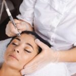 Skin Tag Removal Large