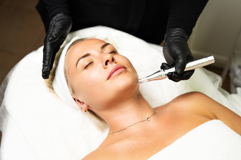 Fraxel Laser vs Microneedling for Acne Scars blog image