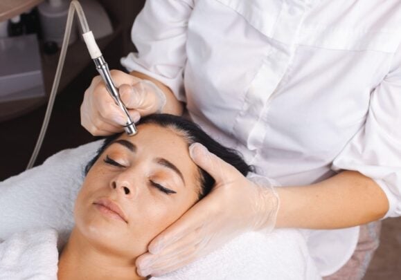 microdermabrasion-toronto